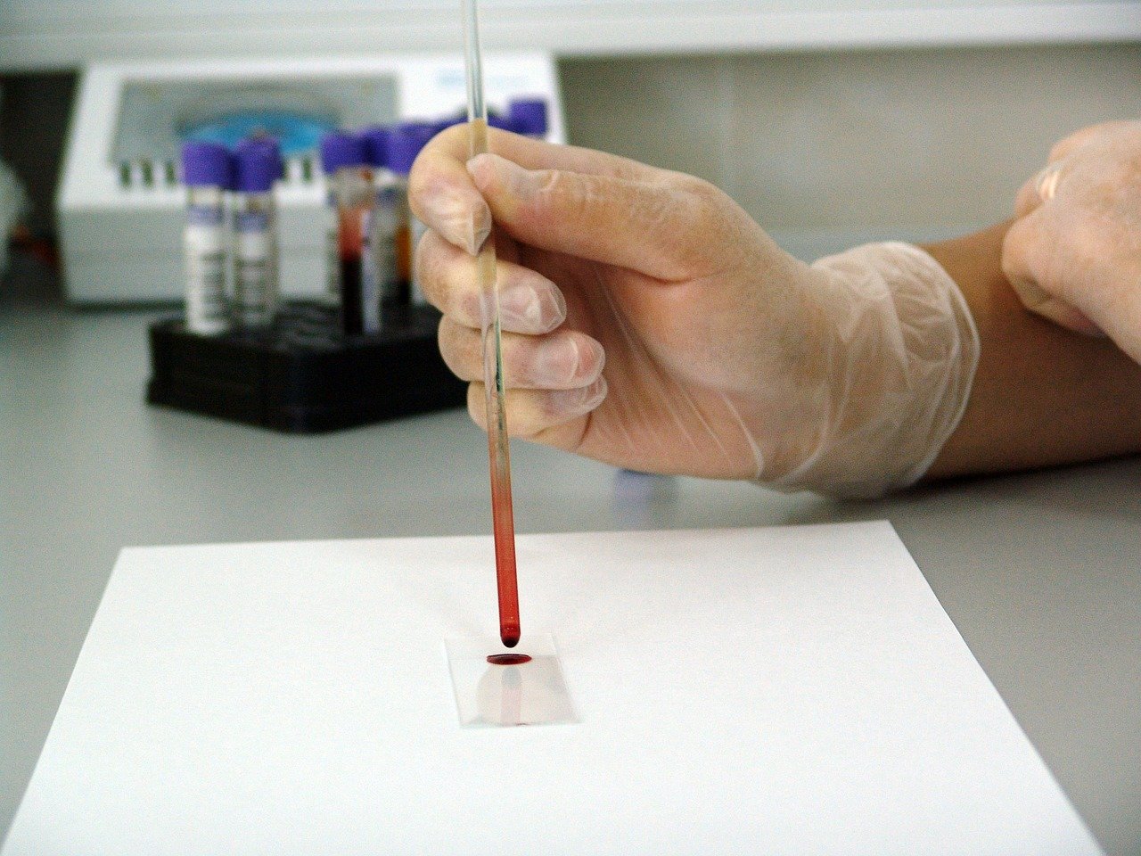 blood, sample, lab-17305.jpg